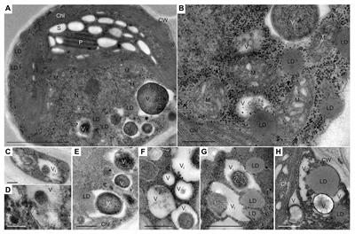 Lipidome Remodeling and Autophagic Respose in the Arachidonic-Acid-Rich Microalga Lobosphaera incisa Under Nitrogen and Phosphorous Deprivation